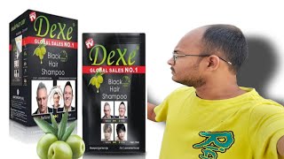 dont use dexe black hair shampoo  honest review by me [upl. by Syhr]