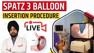 Spatz 3 Balloon Insertion Procedure Video Overview Unboxing Implantation  Orbera Balloon [upl. by Shanahan142]