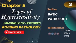 Types Of Hypersensitivity Reactions Robbins Chapter 5 Lecture 2 Immunology Lecture 2 Robbins [upl. by Sidnarb254]