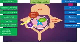 Difference between Extra medullary amp Intra medullary spinal cord lesions [upl. by Meghann]