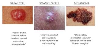 Dermatology on USMLECOMLEX [upl. by Deys]