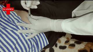 How to Give an Intramuscular Injection Ventrogluteal Buttock Muscle [upl. by Otrevogir]