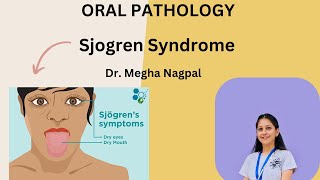 Sjogren Syndrome  Sicca Syndrome  Oral Pathology  Easiest Explanation [upl. by Anoo]