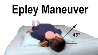 Epley Maneuver to Treat BPPV Dizziness [upl. by Roice783]