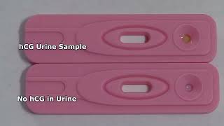 Human Chorionic Gonadotropin HCG  Pregnancy Test Tamil [upl. by Greabe]