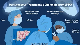 Percutaneous transhepatic cholangiography PTC [upl. by Eatnohs335]