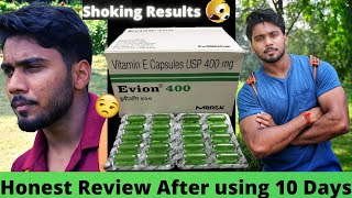 Evion 400 Capsules Honest Review after using 10 Days  Uses Benefits Side Effects [upl. by Tekla]