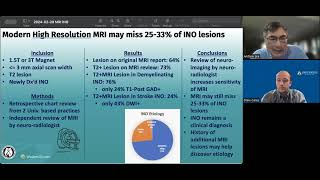 Internuclear Ophthalmoplegia INO on MRI [upl. by Alves795]