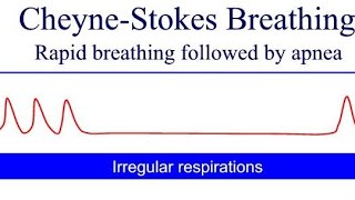 Cheyne Stokes Breathing Pattern  general diseases in human body Cheyne Stokes Kussmauls Biots [upl. by Anderegg]