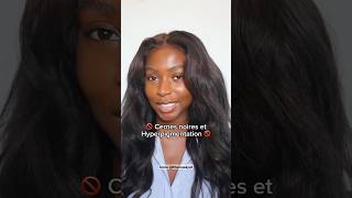 Cernes noires et hyperpigmentation ma solution [upl. by Vincentia]