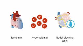 Managing cardiogenic shock [upl. by Gardiner]