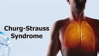 Churg Strauss Syndrome  Eosinophilic Granulomatosis With Polyangiitis Causes and treatment [upl. by Helfand]