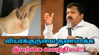 வியர்க்குரு குணமாக உடல் சூடு குறைய பாட்டி வைத்தியம்  DrSivaraman speech on heat rash remedy [upl. by Refenej877]