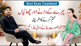 Pimples and Acne Treatment At Home  Skin Care Routine  Dr Huria Arooj  Dr AR Madha [upl. by Lleksah]