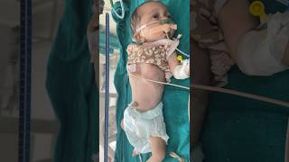 pneumonia retractionsbaby hospital pediatrics doctor babyvideos babyvideos sick preterm [upl. by Adlesirg]