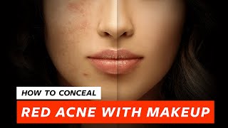 How To Conceal Red Pimples  Acne For An Even Skin  Makeup Tutorial by Pallavi Symons [upl. by Gorman]