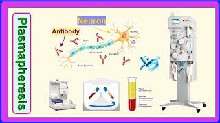 plasmapheresis [upl. by Kacey]