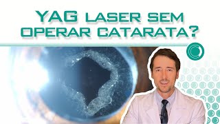 YAG laser sem operar catarata [upl. by Akvir912]