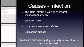 Cervical Lymphadenopathy [upl. by Annaerdna417]