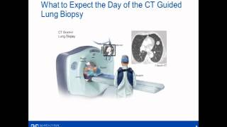 CT Lung Biopsy [upl. by Rosenquist321]