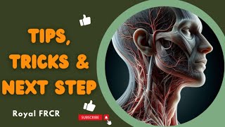 Head amp Neck Imaging  Tips Tricks and Next Step for FRCR 2a [upl. by Minica]