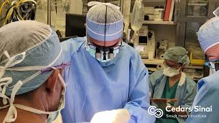 Case Numbers  CedarsSinai Thoracic Surgery—Integrated Residency [upl. by Pennebaker]