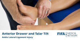 Anterior Drawer and Talar Tilt  Ankle Lateral Ligament Injury [upl. by Fadden]