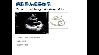 【心エコー】初めての心エコー（UCG）について 第１話 傍胸骨左縁長軸像 [upl. by Ikcir539]