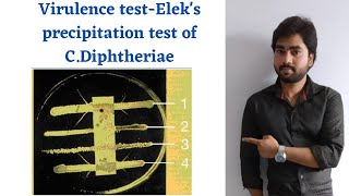 C Diphtheriae  Eleks precipitation test Tissue culture etc By Abhishek sir [upl. by Aldon]