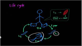 Parasitology 15 Dracunculus »DrMoaz [upl. by Aniteb]