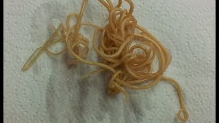 Roundworms in Dogs Toxocara canis amp Toxascaris leonina [upl. by Grimaud]