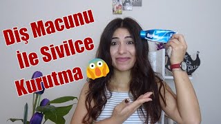 Diş Macunu İle Sivilce İyileştirmek 😵 [upl. by Yort]