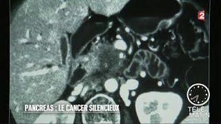 Santé  Pancréas  le cancer du silence [upl. by Jordans]