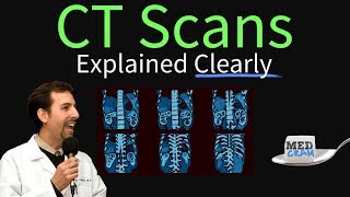 CT Scan of the Chest Explained Clearly  High Resolution CT Scan HRCT [upl. by Elumas111]