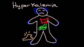 Hyperkalemia [upl. by Nosnek233]