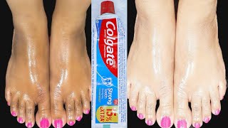 Permanent hand and foot whitening cream  How to Whiten feet Instantly  Colgate for feet whitening [upl. by Mavilia]