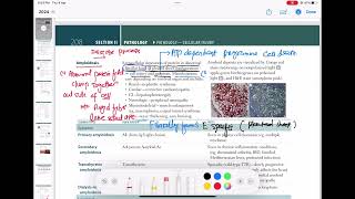 Amyloidosis Pathology 20  First Aid USMLE Step 1 in UrduHindi [upl. by Gavette]