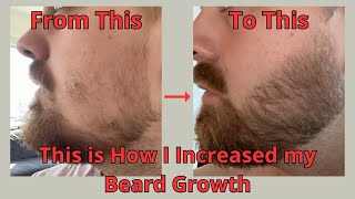 This Is Exactly What I Did To Increase My Beard Growth In Just A Few Months [upl. by Esinrahs]