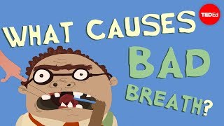 What causes bad breath  Mel Rosenberg [upl. by Gowon]