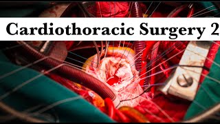 Cardiothoracic surgery Revision part 2 by ASM Minds Team [upl. by Shlomo]