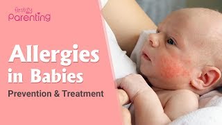 Common Allergies in Babies and How to Handle Them [upl. by Norred]