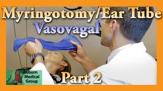 Myringotomy amp Ear Tube Part 2 Vasovagal Feat Dr Tim Fife  Auburn Medical Group [upl. by Ostap]