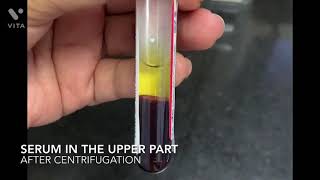 How is serum extracted from the blood sample [upl. by Aniloj]