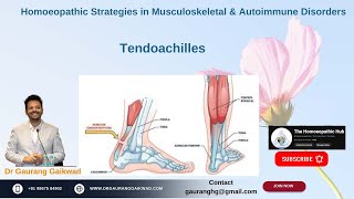 Homoeopathic Strategies in Tendoachilles Dr Gaurang Gaikwad [upl. by Iraam527]