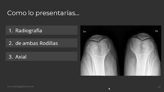 Como Presentar una Radiografia [upl. by Etnasa]