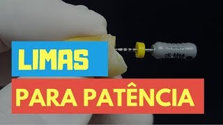 AS 3 LIMAS SENSACIONAIS PARA DAR PATÊNCIA  QUICK TIP ENDOLOVERS [upl. by Tterrab819]