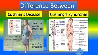 Difference Between Cushing’s Disease and Cushing’s Syndrome [upl. by Alliuqaj279]