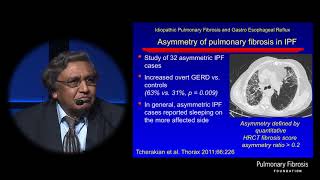 Gastroesophageal Reflux Disease GERD in ILD  Ganesh Raghu MD [upl. by Eiramoj]