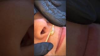 upper lip hair removal shorts youtubeshorts shortvideo youtube viralshorts short viral [upl. by Llecrep952]