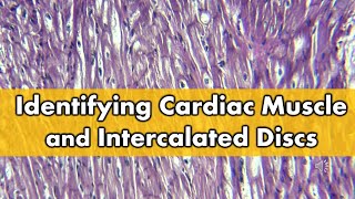 Fibrocartilage vs Cardiac Muscle Histology FAQ [upl. by Juley131]